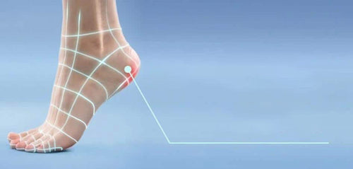 What are Cracked Heels? Causes, Signs & Management