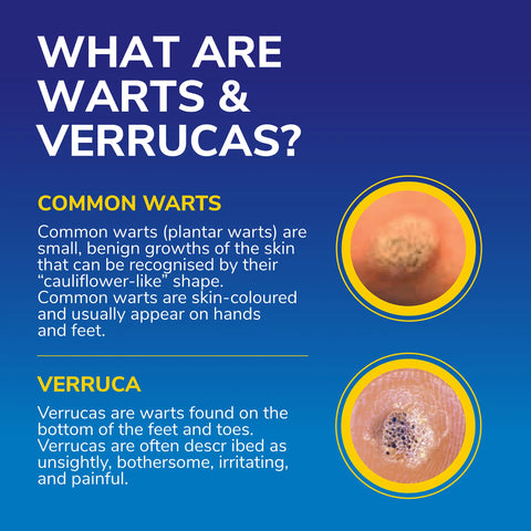 Varruuca Dr. Scholl’s™ Freeze Away MAX Verruca and Wart Remover – Scholl Australia