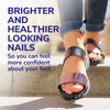 Dr. Scholl's™ Nail Revitaliser Serum 10ml